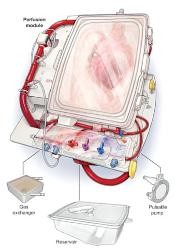 Image: The TransMedics organ care system (OCS) Heart (Photo courtesy of TransMedics).