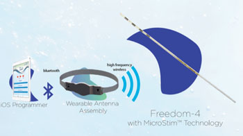 Image: The Freedom Spinal Cord Stimulation (SCS) system (Photo courtesy of Stimwave Technologies).