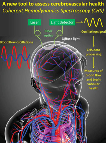 Image: New optical diagnostic technology promises new ways to identify and monitor brain damage resulting from traumatic injury, stroke, or vascular dementia—in real time and without invasive procedures (Photo courtesy of Tufts University).