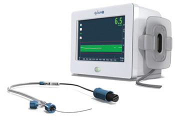 Image: The GlySure continuous intravascular glucose monitoring system (Photo courtesy of GlySure).