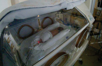 Image: Premature baby receiving parenteral nutrition (Photo courtesy of the University of Montreal).