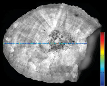Image: A kidney stone being analyzed automatically using Raman spectrosopy (Photo courtesy of Fraunhofer IPM).