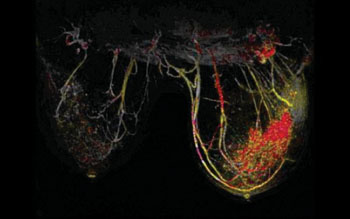 Image: A diagnostic DWIBS MRI mammography demonstrating a lesion (Photo courtesy of DKFZ). Image: A diagnostic DWIBS MRI mammography demonstrating a lesion (Photo courtesy of DKFZ).