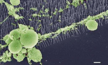 Image: Neurons climbing on the nanowires (Photo courtesy of Lund University).