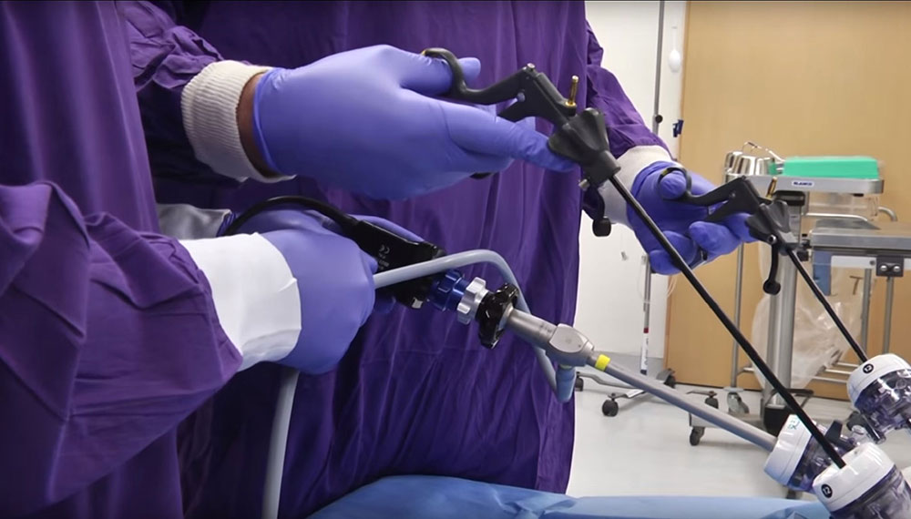 Image: Using the CholeVision dedicated laparoscopic tool during cholecystectomy (Photo courtesy of the Hebrew University, Jerusalem, Israel).