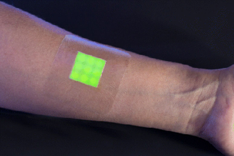 Image: The intelligent hydrogel wound dressing (Photo courtesy of the University of Bath).