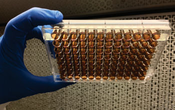 Image: Primordial goo inspired polymer coating for implants (Photo courtesy of CSIRO).