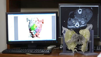 Image: 3-D color segmentation of CT data with 3D model (Photo courtesy of Texas Children\'s Hospital).