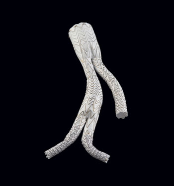 Image: The Gore Excluder Iliac Branch Endoprosthesis (Photo courtesy of Gore Medical Products).
