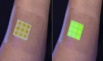 Image: The prototype of the ‘smart’ wound dressing: not infected (L), infected (R) (Photo courtesy of the University of Bath).
