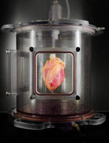 Image: A partially recellularized human whole-heart cardiac scaffold cultured in a bioreactor (Photo courtesy of MGH Center for Regenerative Medicine).