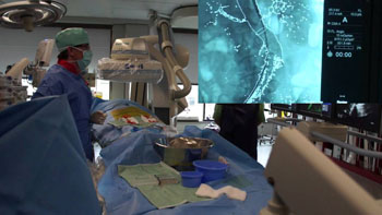 Image: The EVAR-3D Guidance for endovascular repair of the aorta (Photo courtesy of Siemens Healthcare / YouTube). Image: The EVAR-3D Guidance for endovascular repair of the aorta (Photo courtesy of Siemens Healthcare / YouTube).