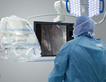 Image: The EVAR Guidance Engine in operation (Photo courtesy of Siemens Healthcare).
