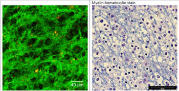 Image: A comparison of THG (L) to a myelin-hematoxylin stain (R) (Photo courtesy of Marloes Groot / VU University).