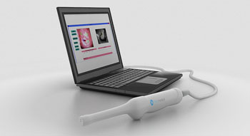 Image: The vaginal probe device, designed for cervical cancer screening (Photo courtesy of Biop Medical).