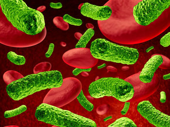 Image: Sepsis infection caused by bacteria, which can lead to organ failure and death (Photo courtesy of the CDC).