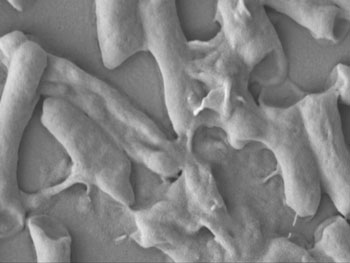 Image: E.coli bacteria destroyed by the imidazolium oligomers (Photo courtesy of IBN / A*STAR).