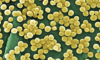 Image: MRSA bacteria (Photo courtesy of Tim Sandle, PhD / NIH).