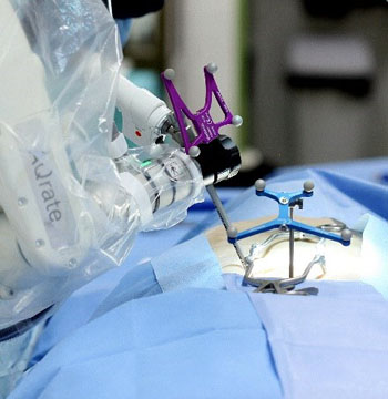 Image: The AQrate Robotic Assistance System (Photo courtesy of KB Medical).