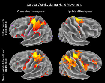 Image: An example of a functional Magnetic Resonance Imaging (fMRI) scan (Photo courtesy of the Athinoula A. Martinos Center for Biomedical Imaging at Massachusetts General Hospital). Image: An example of a functional Magnetic Resonance Imaging (fMRI) scan (Photo courtesy of the Athinoula A. Martinos Center for Biomedical Imaging at Massachusetts General Hospital).