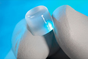 Image: The Cartiva Synthetic Cartilage Implant (SCI) (Photo courtesy of Cartiva).