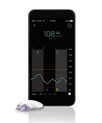 Image: The Guardian Connect mobile CGM system and app (Photo courtesy of Medtronic).