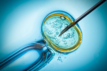 Image: The IVF insemination procedure (Photo courtesy 123rf.com).