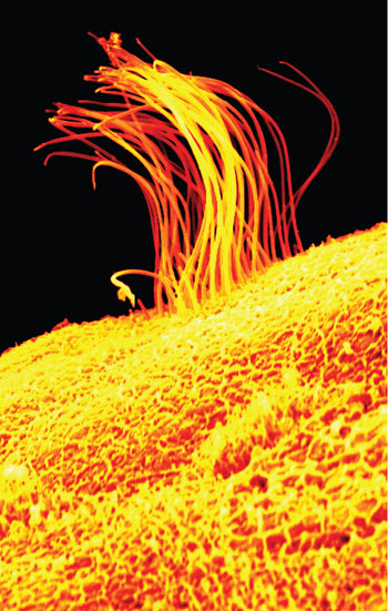 Image: A multi-ciliated cell, as seen in a scanning electron micrograph (SEM) (Photo courtesy of Biomedical Optics Express). Image: A multi-ciliated cell, as seen in a scanning electron micrograph (SEM) (Photo courtesy of Biomedical Optics Express).