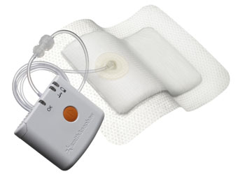 Image: The PICO NPWT system and dressing (Photo courtesy of Smith & Nephew).