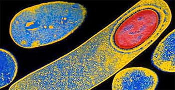 Image: Clostridium difficile spores (Photo courtesy of TechLab).