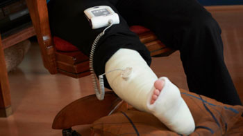 Image: A new study casts doubt on the assumption that LIPUS treatment can improve the chances of recovery after surgery for a shinbone fracture (Photo courtesy of Bioventus Global/Handout).