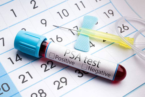Image: A new study suggests PSA tests may hold no prostate cancer screening benefit (Photo courtesy of 123rf.com).