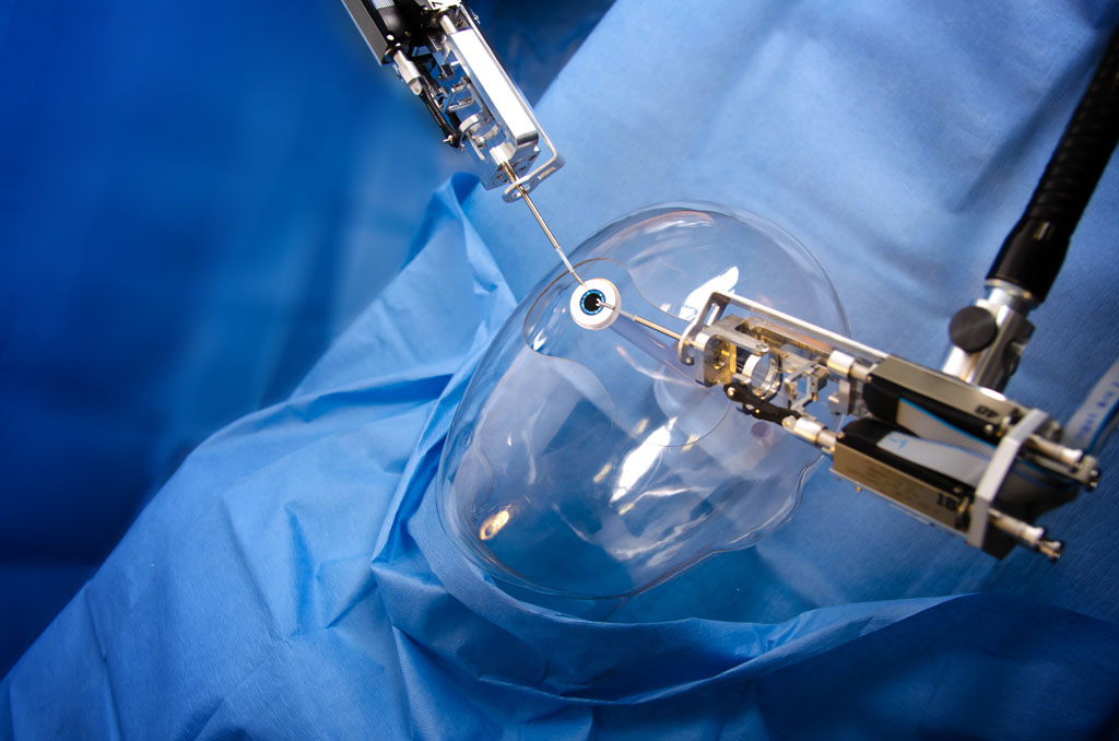 Image: The Axsis prototype surgical robot could revolutionize cataract surgery (Photo courtesy of Cambridge Consultants).