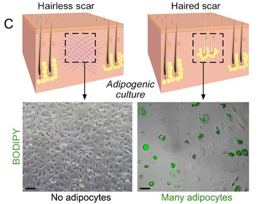 Image: Hair follicles induce adipocytes that promote scarless healing (Photo courtesy of the University of Pennsylvania).