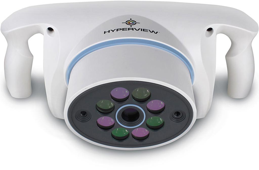 Image: The Hyperview hyperspectral tissue oxygenation device (Photo courtesy of HyperMed Imaging).