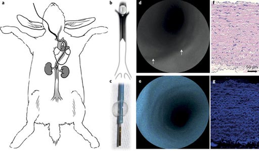 Image: A high-definition multimodal SFE of the carotid artery (Photo courtesy of U-M). Image: A high-definition multimodal SFE of the carotid artery (Photo courtesy of U-M).