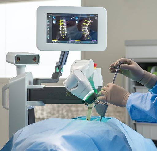 Image: The Mazor X surgical guidance system (Photo courtesy of Mazor Robotics).
