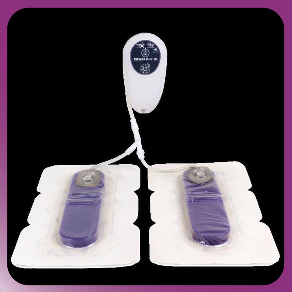 Image: The Prevena Duo Incision Management System (Photo courtesy of Acelity).