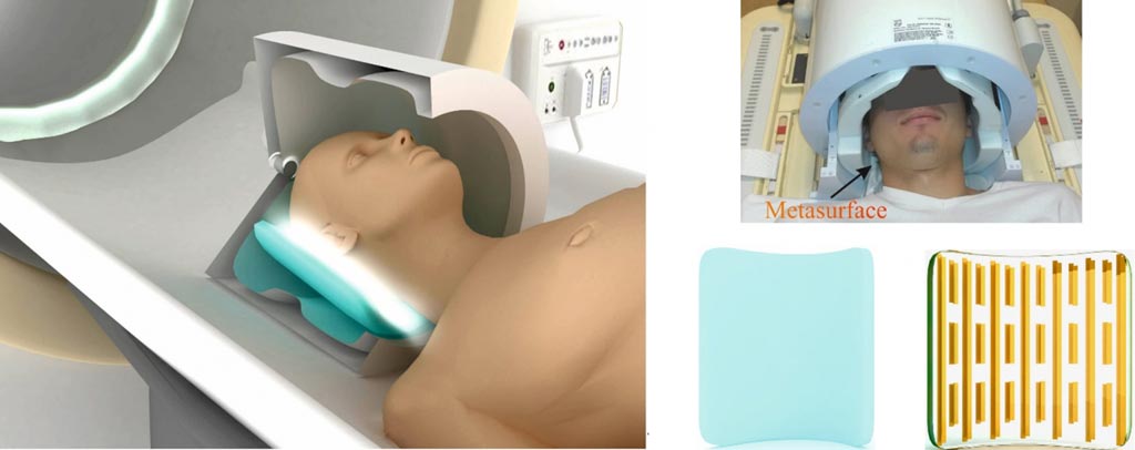 Image: A patient inside an MRI scanner with metasurface-enhanced coil arrays (Photo courtesy of ITMO University).