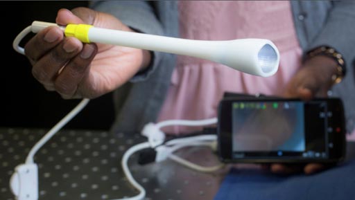 Image: Research asserts a prototype mini colposcope can make cervical cancer screening more accessible (Photo courtesy of Duke University).