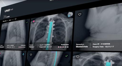 Image: The UNiD HUB digital spinal surgery planning software (Photo courtesy of Medicrea).