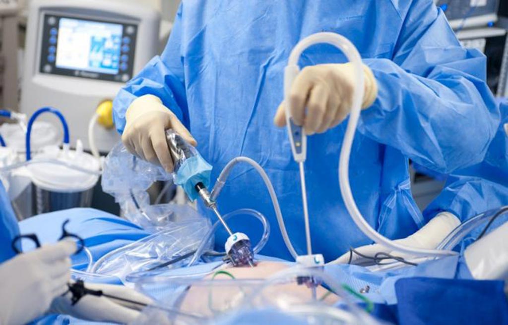 Image: According to a new study, MIS shows better outcomes in most surgical procedures (Photo courtesy of Alamy).