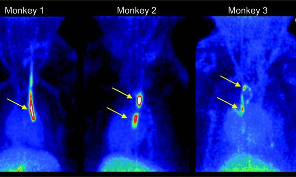 Image: Strong signals are detected at the sites where inserted catheters had roughened surfaces. Almost no other background signal is visible. Only accumulation in the gallbladder becomes visible at the bottom of the image (Photo courtesy of Piramal Imaging).