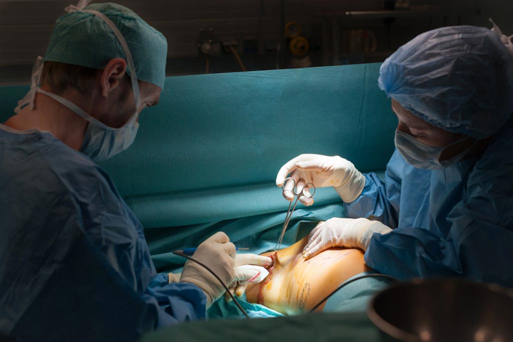 Image: Research shows that surgeons’ opinion sways patient acceptance of contralateral breast removal (Photo courtesy of Fotolia).