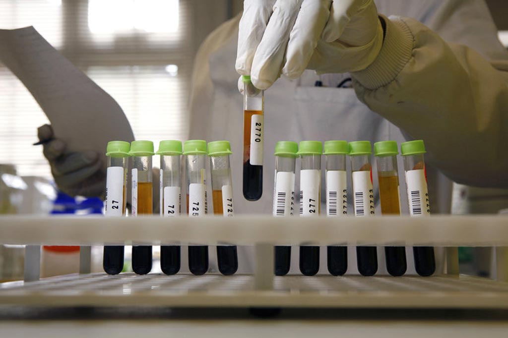Image: New research asserts too many tests may do more harm than good (Photo courtesy of Medicimage).