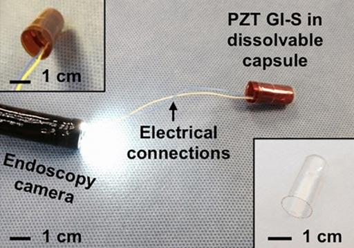 Image: An ingestible capsule can help measure GI motility (Photo courtesy of MIT).
