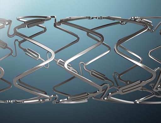 Image: A novel dynamic drug eluting stent allows arteries to pulsate (Photo courtesy of Elixir Medical).