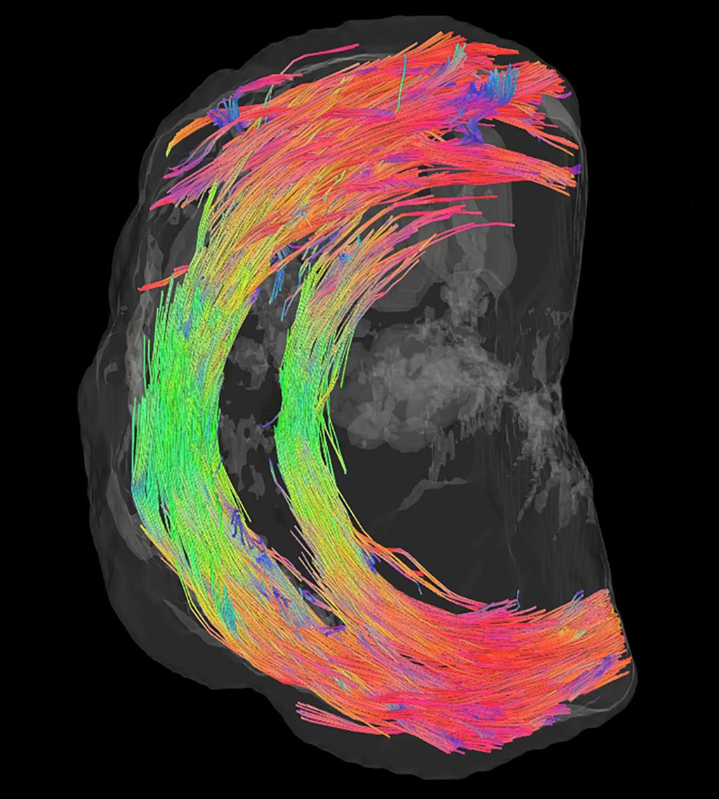 Image: The fibers encircling the cervical canal provide strength and support (Photo courtesy University of Leeds). Image: The fibers encircling the cervical canal provide strength and support (Photo courtesy University of Leeds).