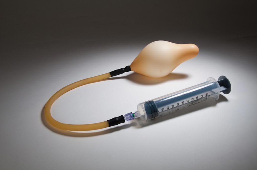 Image: An intrauterine balloon tamponade device (Photo courtesy of Alpha Image).