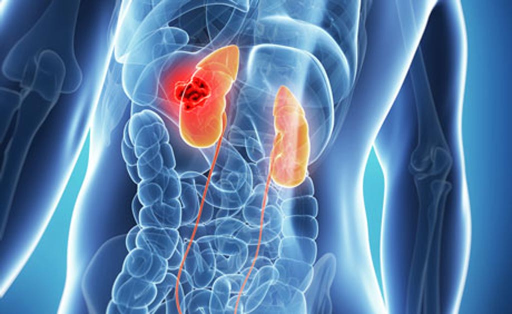 Image: A new study shows obesity surgery can protect against kidney disease (Photo courtesy of SA).